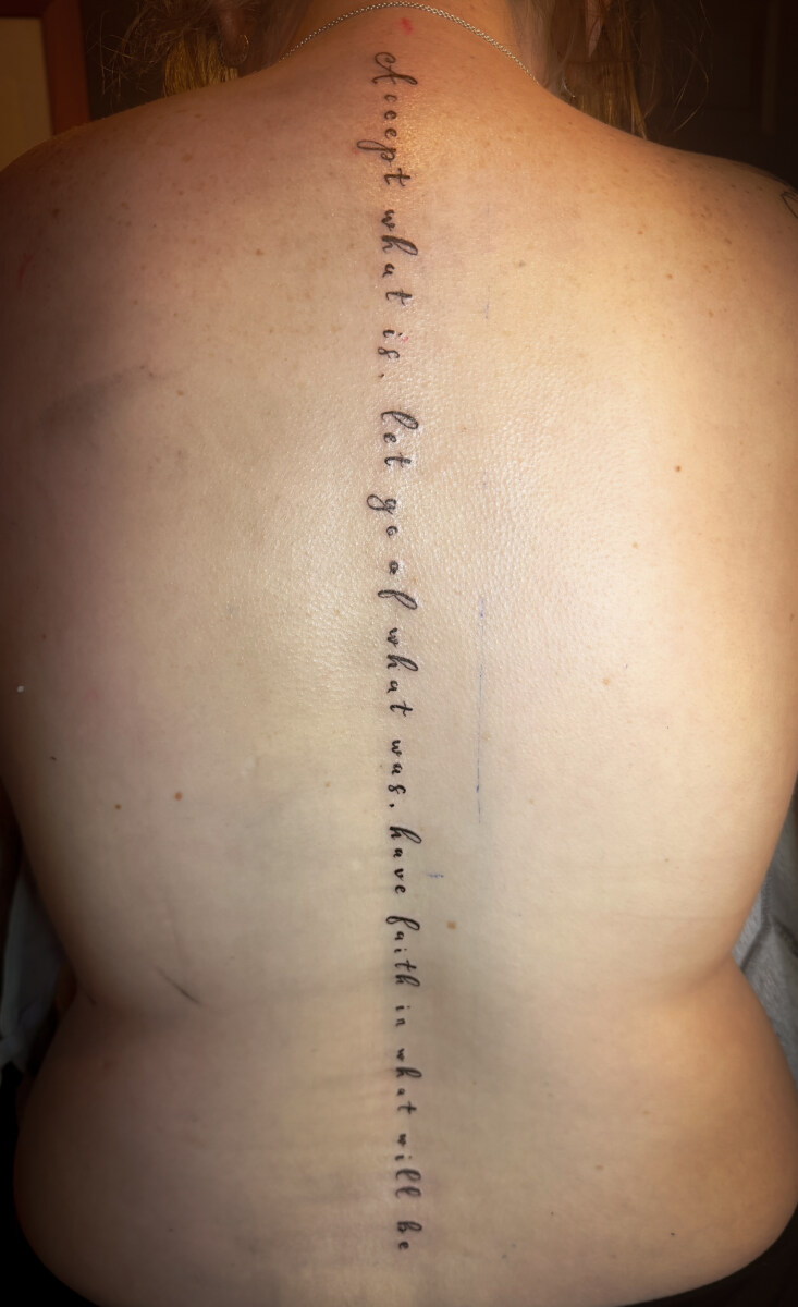 Vertical Spinal Quote